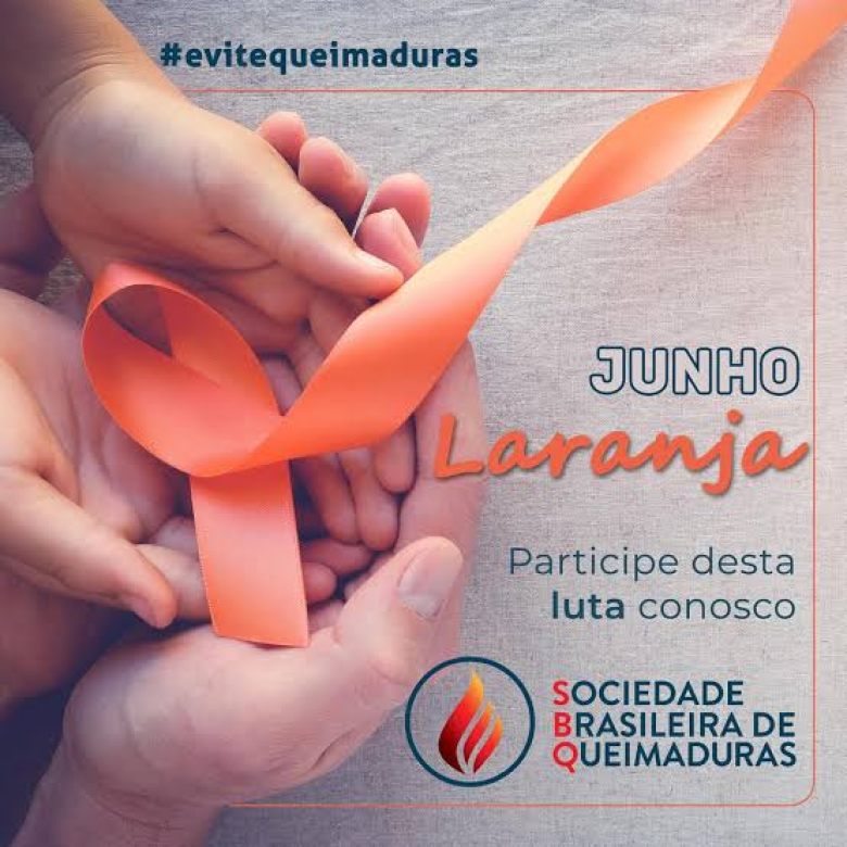 QUEIMADURAS